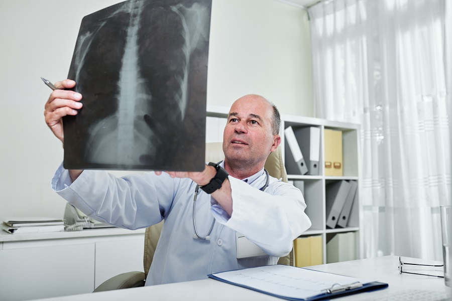Mature general practitioner sitting with cardiogram on his table and looking at chest x-ray of patient
